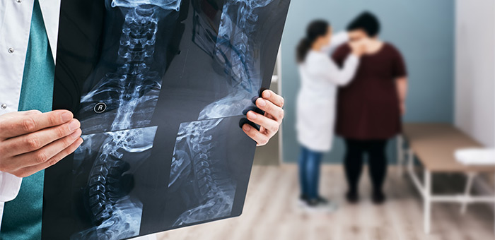 chiropractic for auto accident