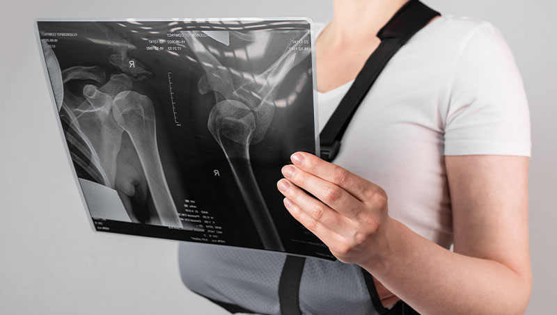 shoulder pain after car accident in La Verne