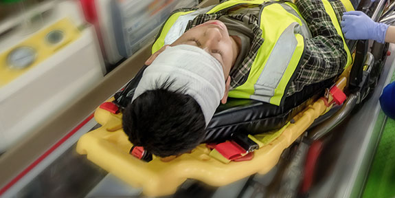 traumatic brain injury treatment in La Verne after an auto accident
